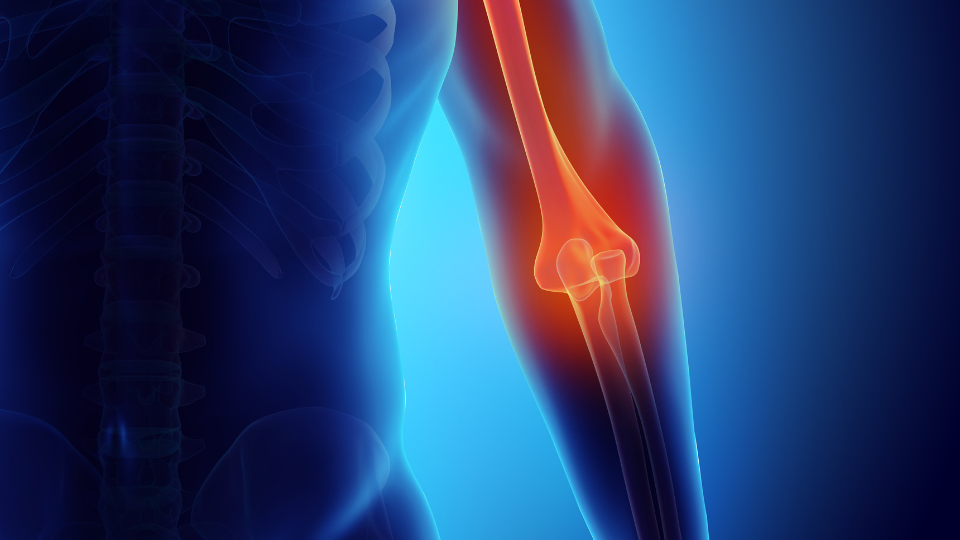 shoulder and elbow pain | Klamath Orthopedic Clinic and Sports Medicine